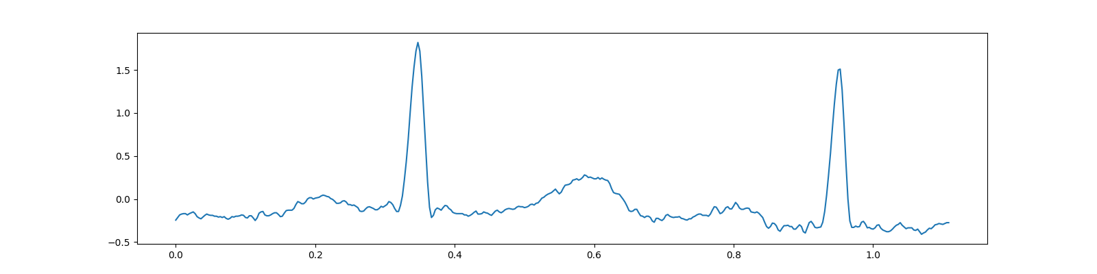 ecg cs bsbl