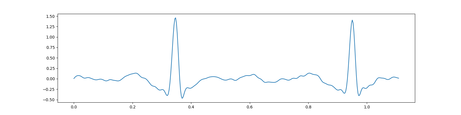 ecg cs bsbl