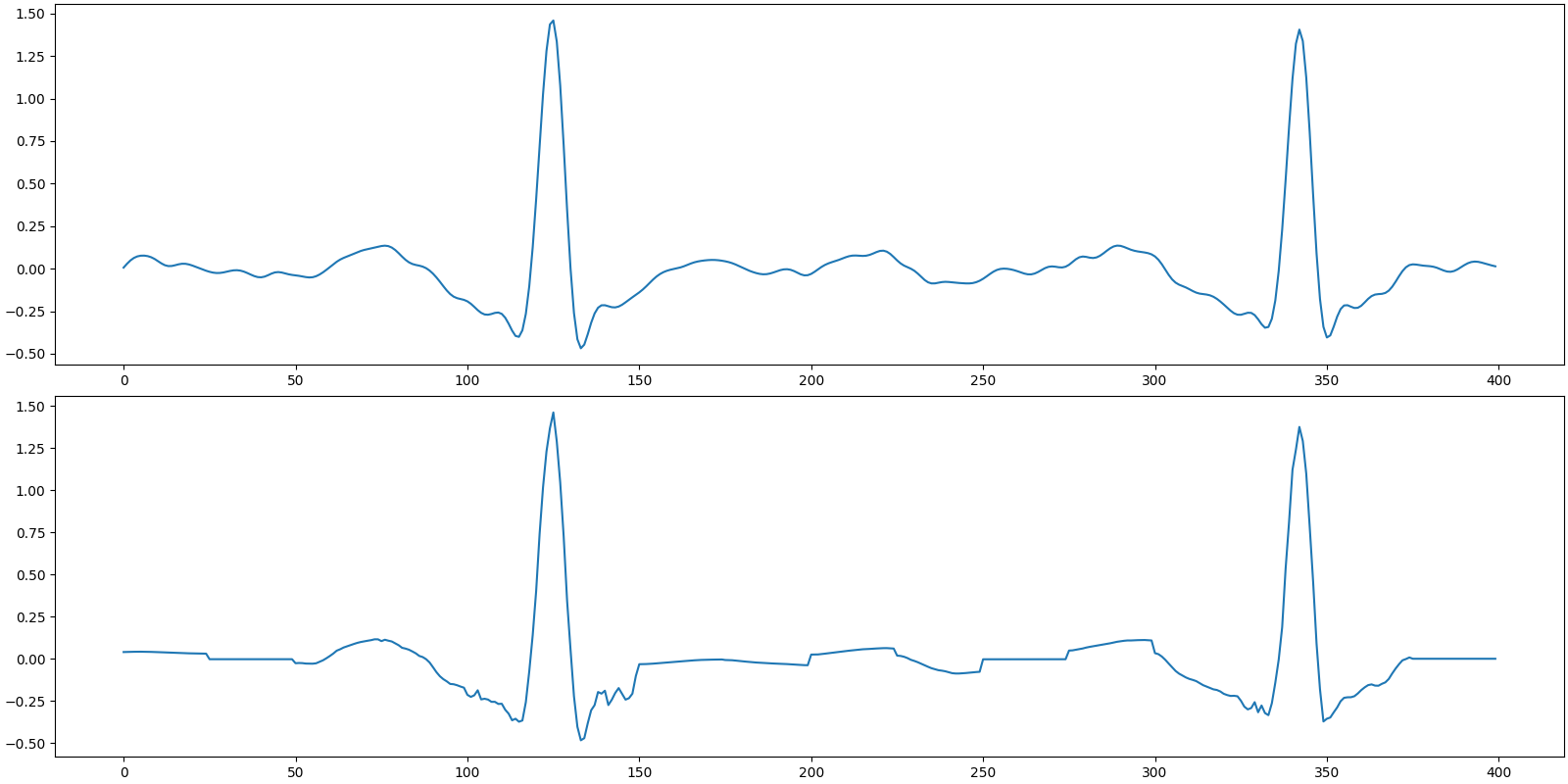 ecg cs bsbl